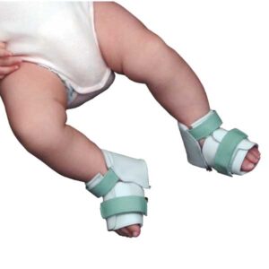 Ortesis de corrección infantil - BB