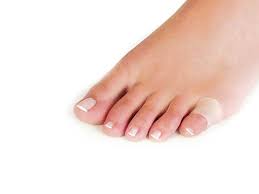 Anillo protector para el 5 dedo Ref: CG1701